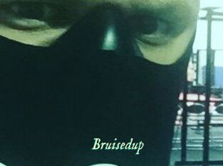 Bruisedup