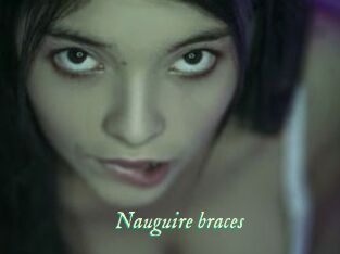 Nauguire_braces